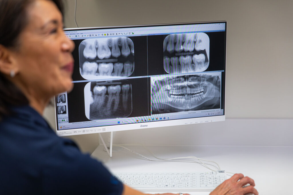 een röntgenfoto van een gebit